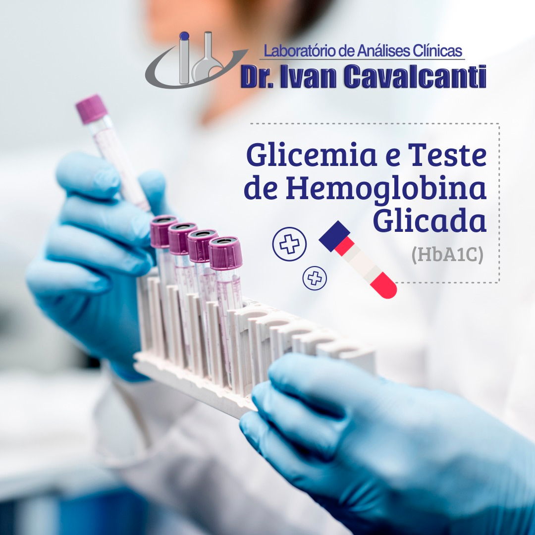 Glicemia E Teste De Hemoglobina Glicada Laboratório De Análises Clínicas Dr Ivan Cavalcanti 5409